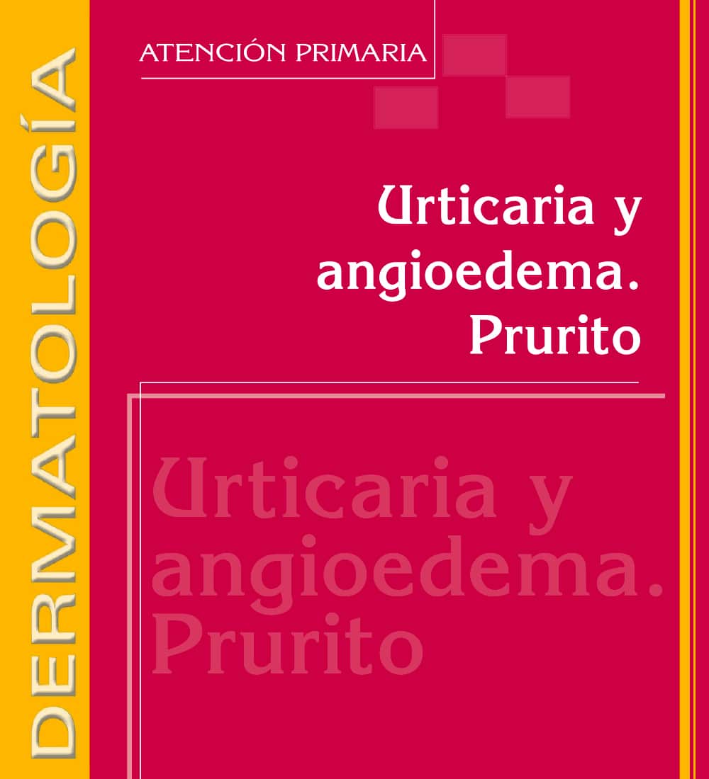 Imagen publicación Urticaria y Angioedema - Prurito - Dermatología