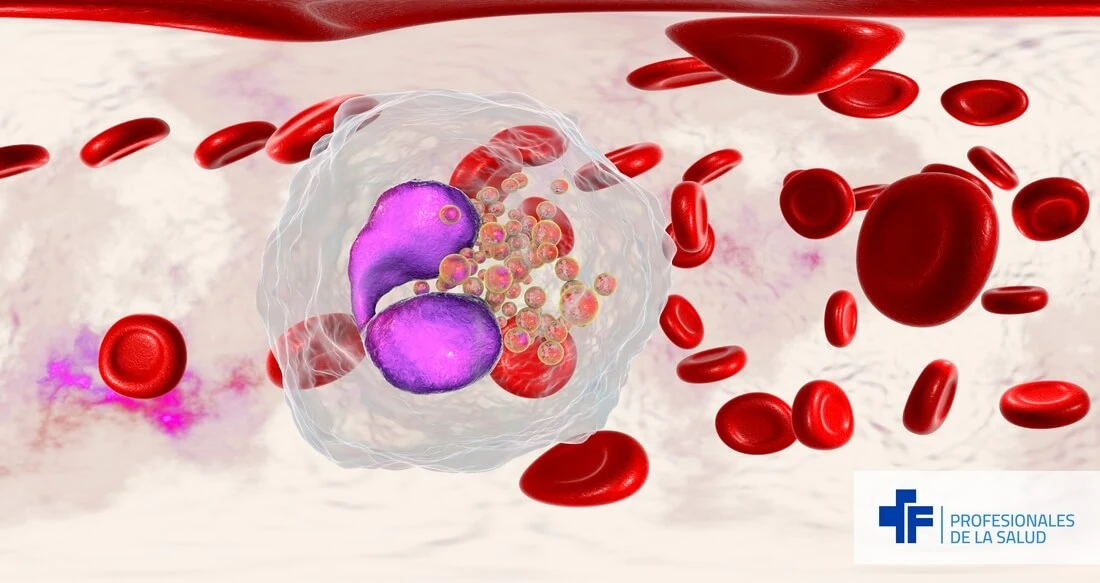 Ilustración de un eosinófilo, célula relevante en el manejo del paciente con EPOC.