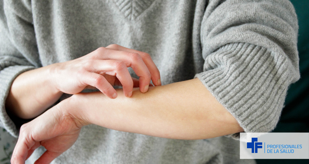 Mujer rascándose el brazo por picor